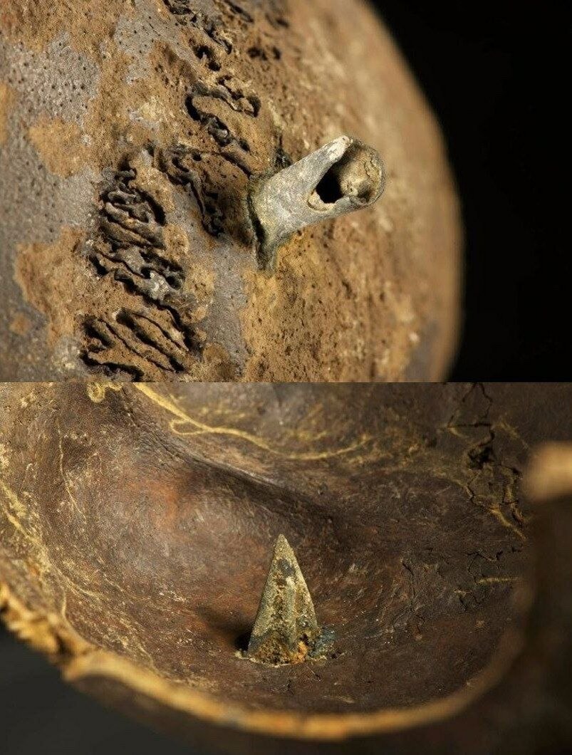 Bronze arrowhead lodged in a human skull found at a Bronze Age battle site on the banks of the Tollensee River - Screenshot, Archeology, Ancient artifacts, The science