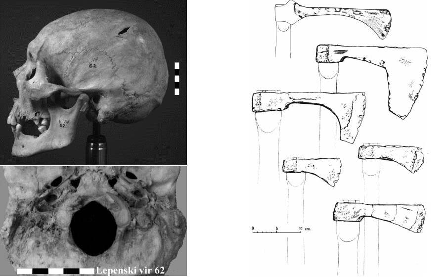 The wrong side of war. Medieval Wounds (Remastered) - My, Military history, Middle Ages, Archeology, Armor, Steel arms, Injury, Post #11637635, Longpost