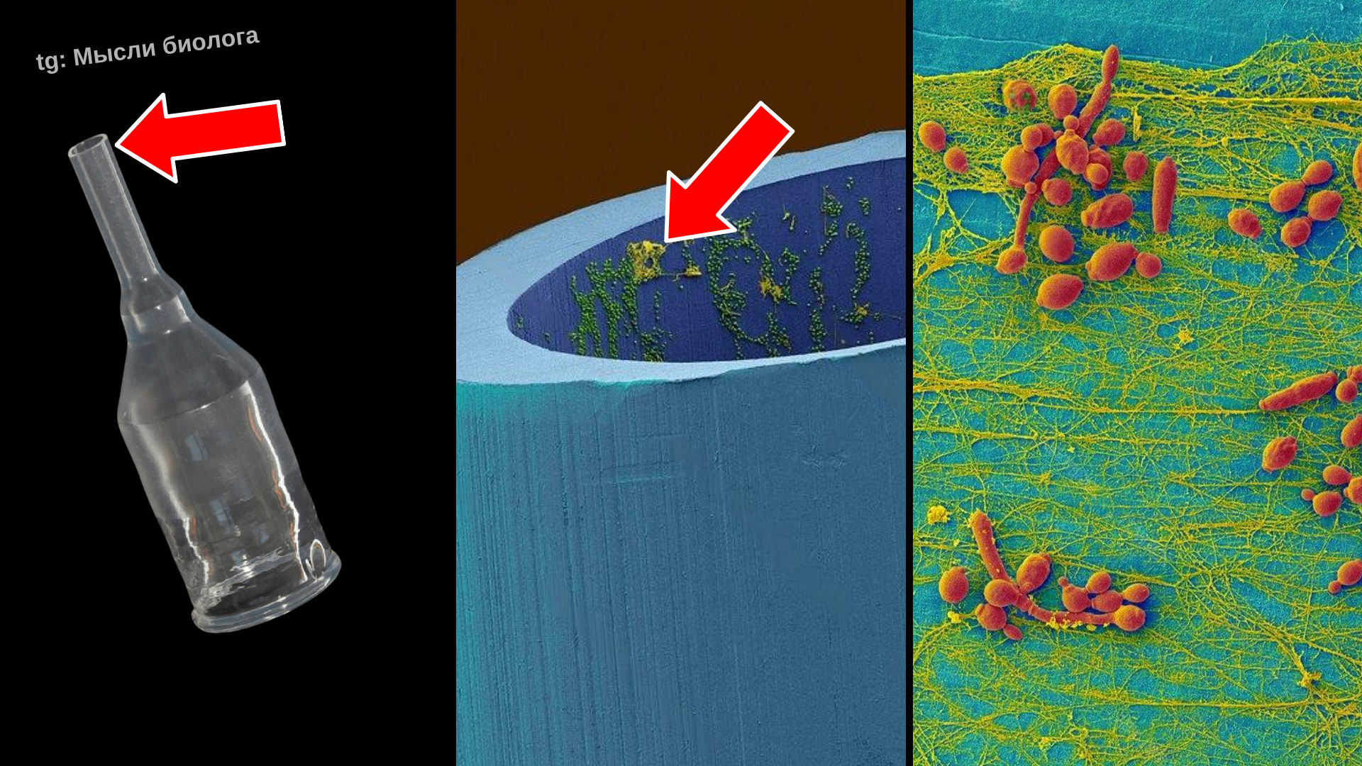 Bacteria and fungi on the surface of medical devices - My, Research, The science, Nauchpop, Biology, Longpost