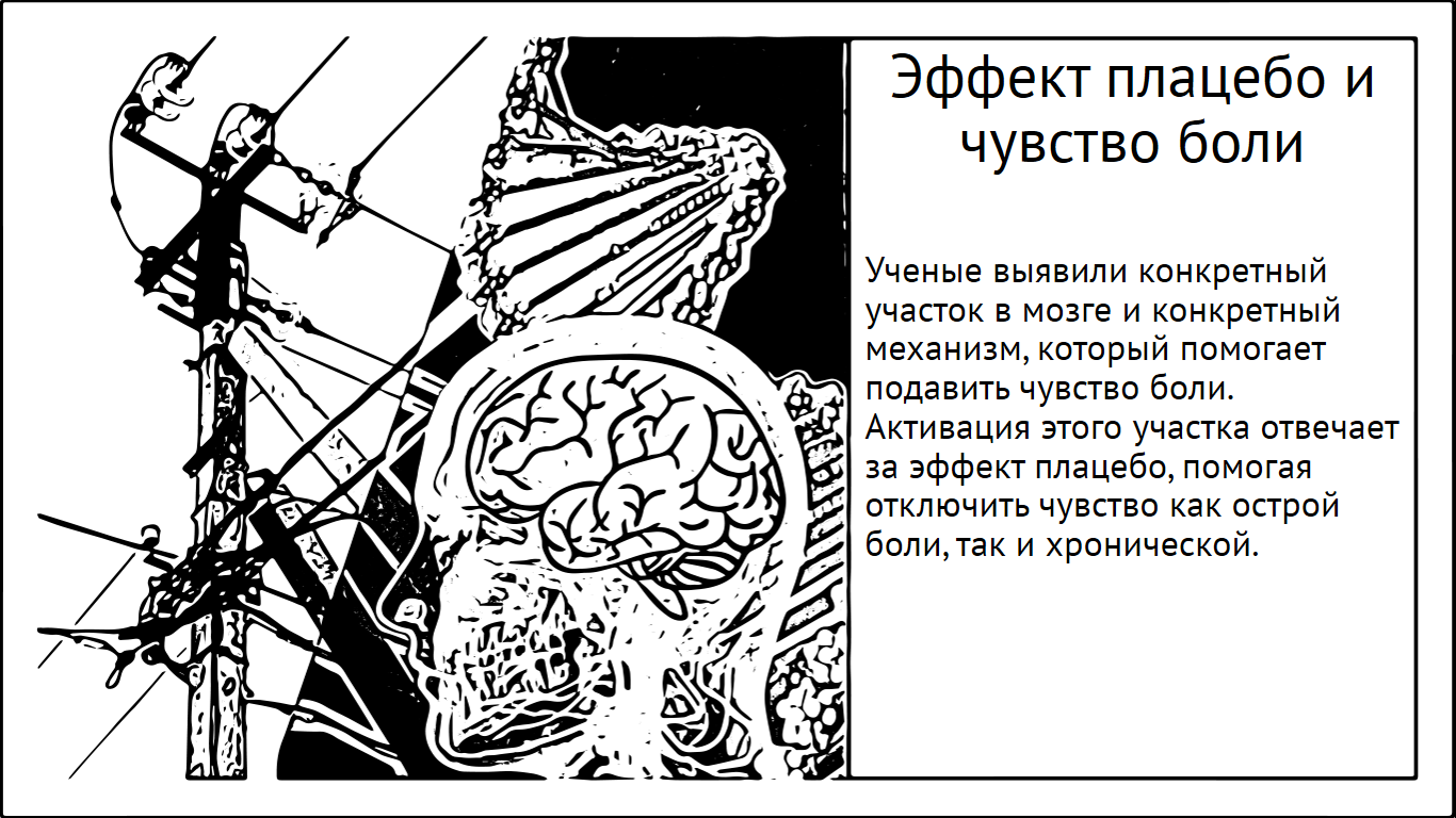 Эффект плацебо и чувство боли. Как мозг перепрошивает себя - Моё, Мозг, Исследования, Наука, Научпоп, Эксперимент, Плацебо, Боль, Длиннопост