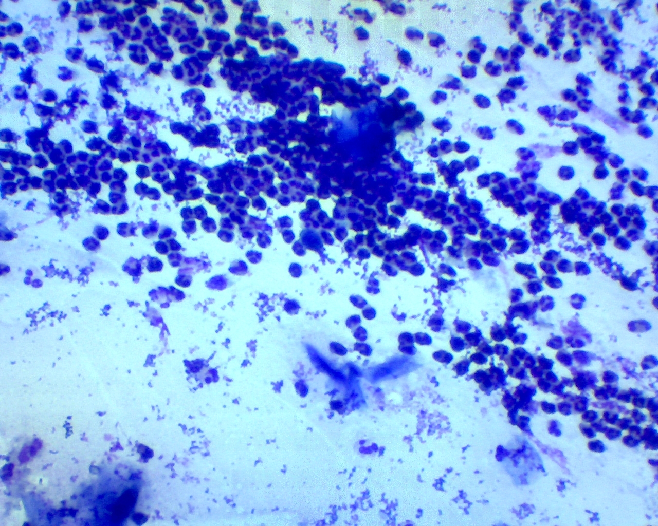 DIY nasocytogram. An amazing microcosm of snot - My, Microscope, The medicine, Nose, Video, Soundless, Longpost