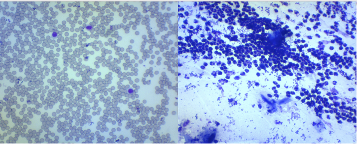 DIY nasocytogram. An amazing microcosm of snot - My, Microscope, The medicine, Nose, Video, Soundless, Longpost