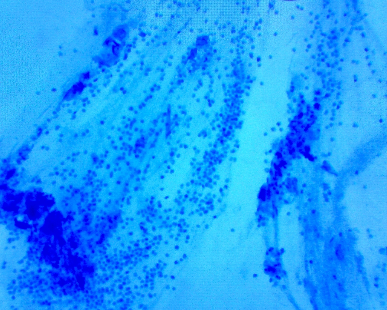 DIY nasocytogram. An amazing microcosm of snot - My, Microscope, The medicine, Nose, Video, Soundless, Longpost