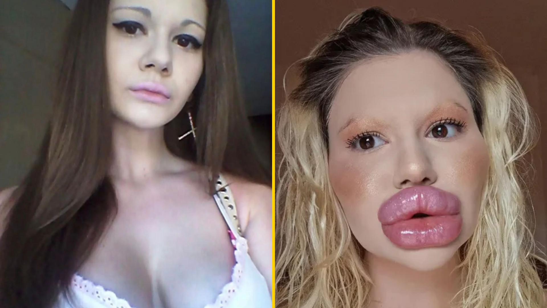 'Bulgarian Barbie' claims she has the biggest lips in the world - Lips, Plastic surgery, Longpost