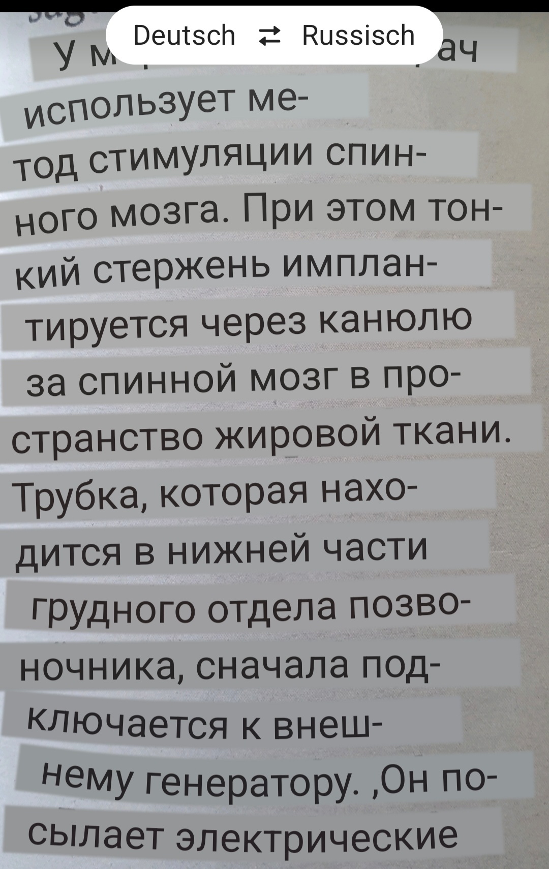 Нейромодулятор против хронических болей - Моё, Здоровье, Боль, Новинки, Длиннопост