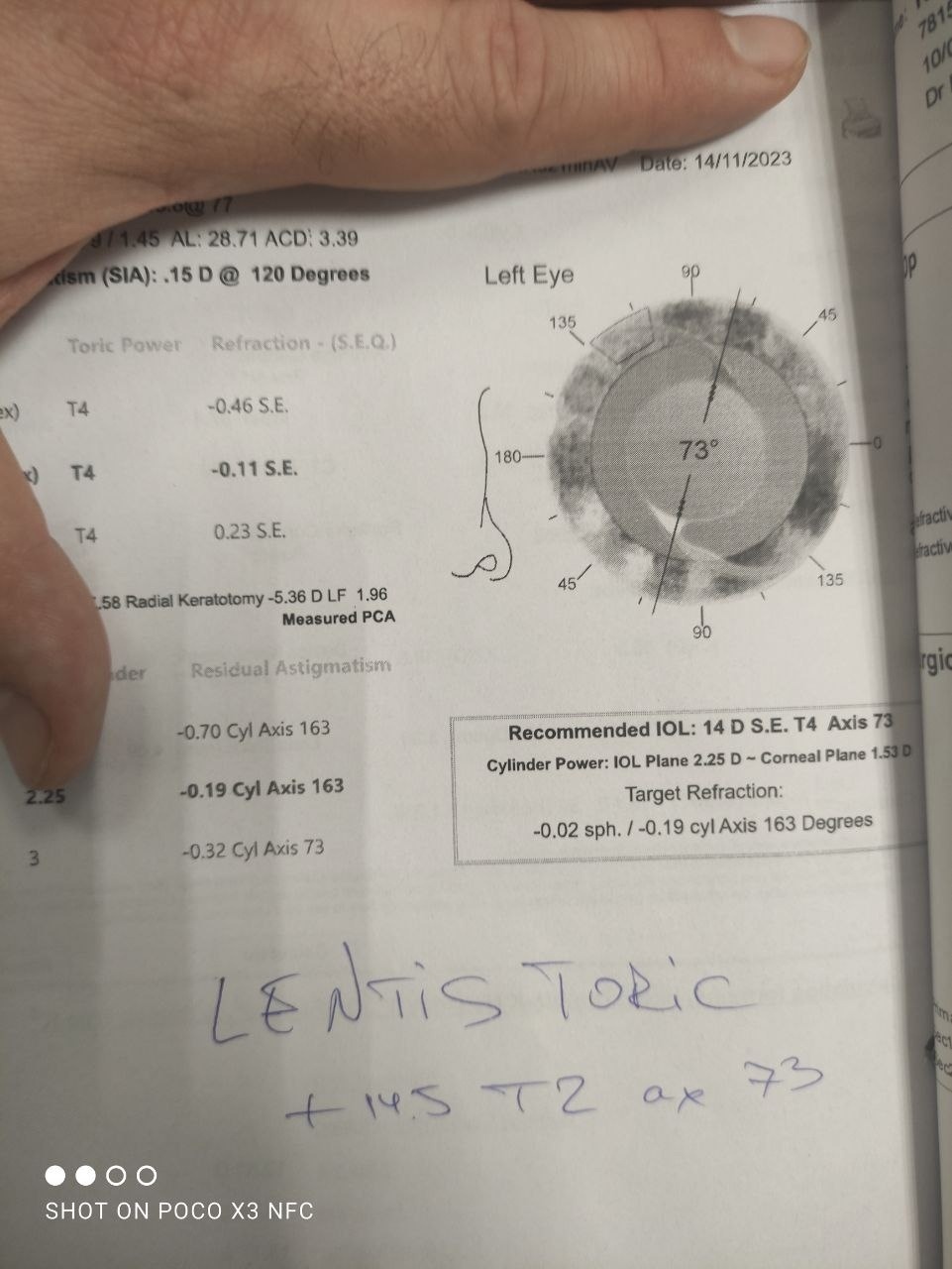 One day a lady comes to see me, who once upon a time had incisions made on her cornea - My, Doctors, The medicine, Ophthalmology, Telegram (link), Eyes, Longpost