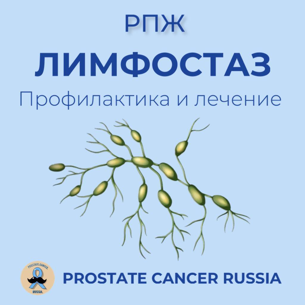 Lymphostasis prevention and treatment - Cancer and oncology, Prostate cancer, Longpost