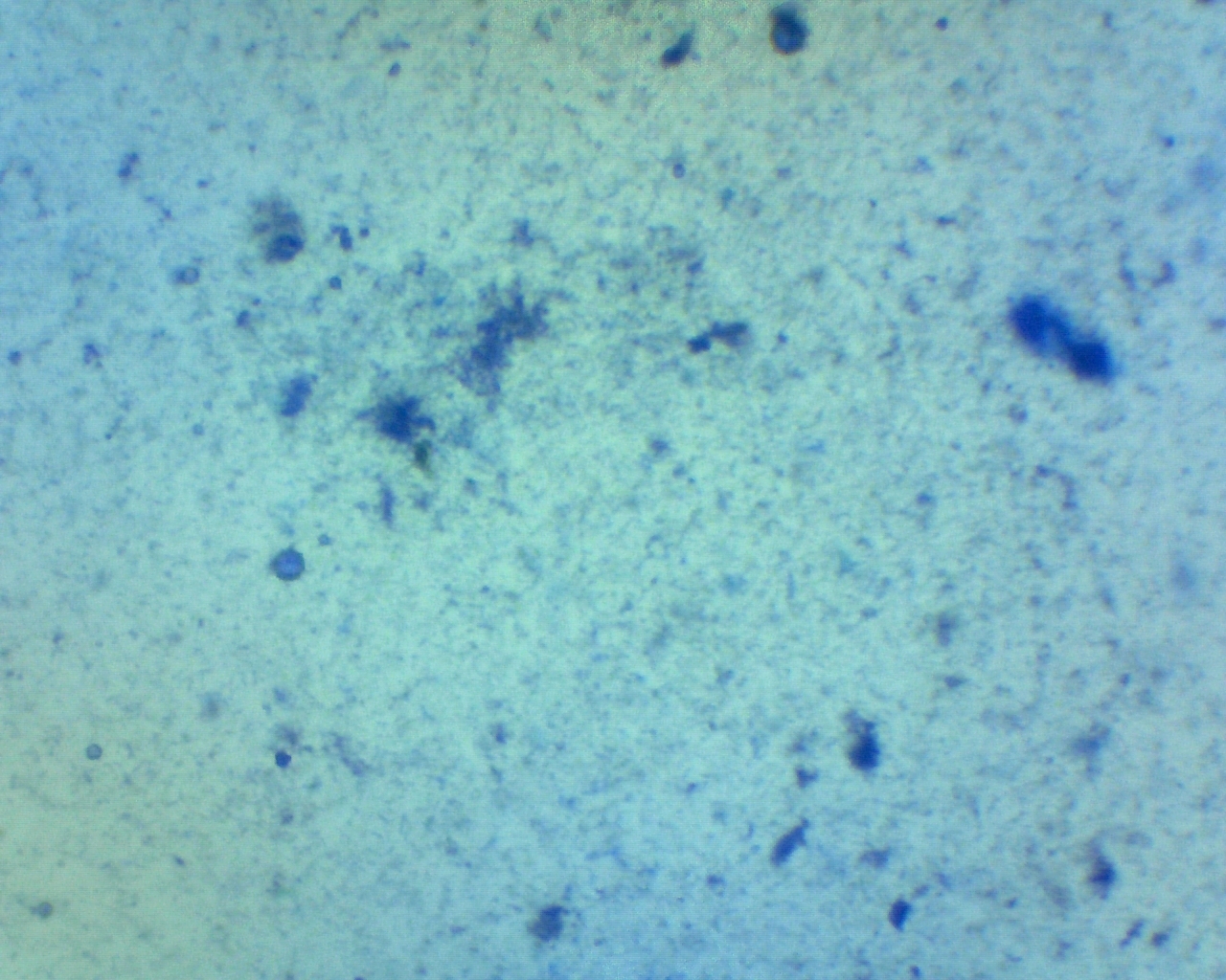 Bacteria inside the dishwasher - My, Microscope, Bacteria, Longpost