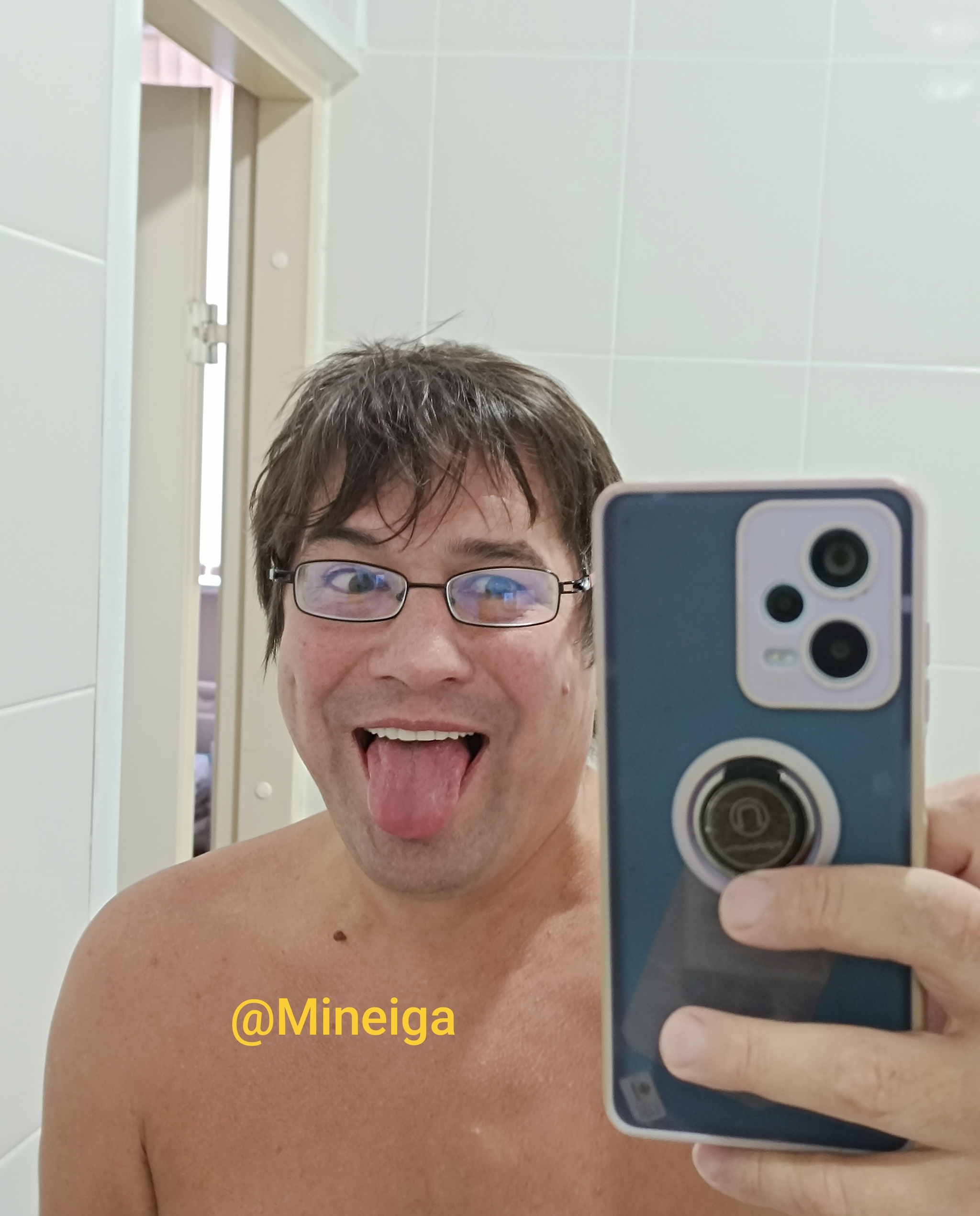 My brain will see the light and people's eyes! And for now I do good deeds in MONIKI. I am one powerful healthy boar here)) @Mineiga - My, The medicine, Operation, Video, Vertical video, Longpost