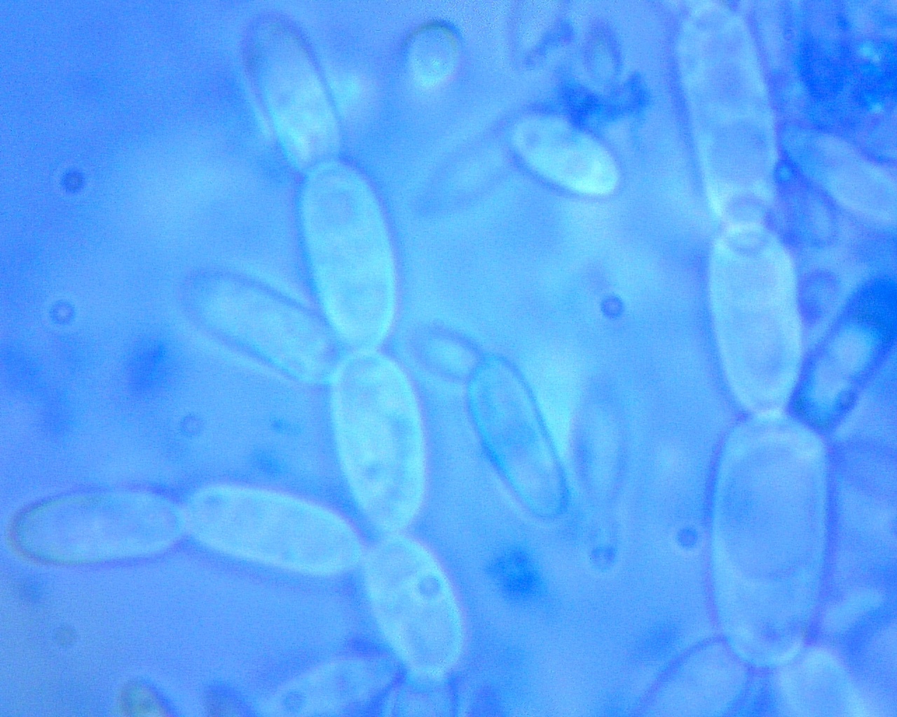 Yeast on grapes - My, Yeast, Microscope, Longpost, Repeat