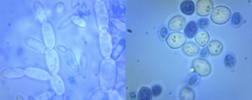 Yeast on grapes - My, Yeast, Microscope, Longpost, Repeat