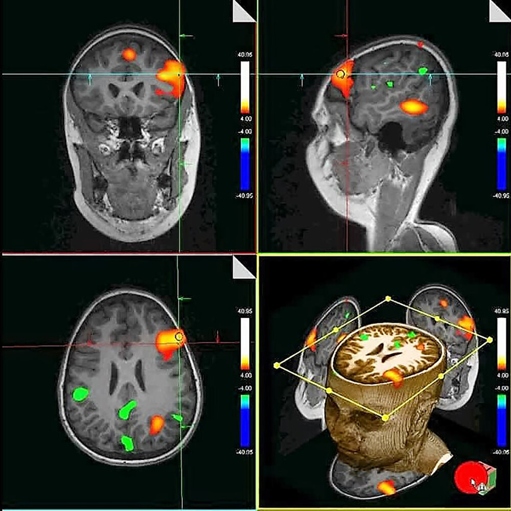 Atheism and Brain Tomography - My, Nauchpop, The science, Research, Physics, Religion, Science and religion, Atheism, MRI, The medicine, Physiology, Evolution, Нейронные сети, Neurobiology, Longpost