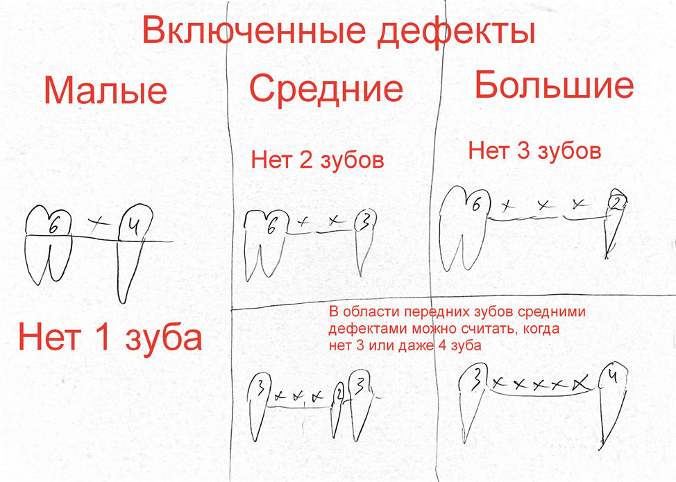 Сага о стоматологии. Глава 96. Какие бывают методы восстановления зубов? - Моё, Зубы, Врачи, Стоматология, Медицина, Протез, Здоровье, Импланты, Коронки, Лечение, Стоматолог, Беззубик, Болезнь, Проблема, Вопрос, Ответ, Длиннопост