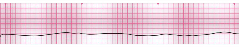 An unusual case in intensive care - Doctors, Ambulance, Disease history, Yandex Zen, Yandex Zen (link)