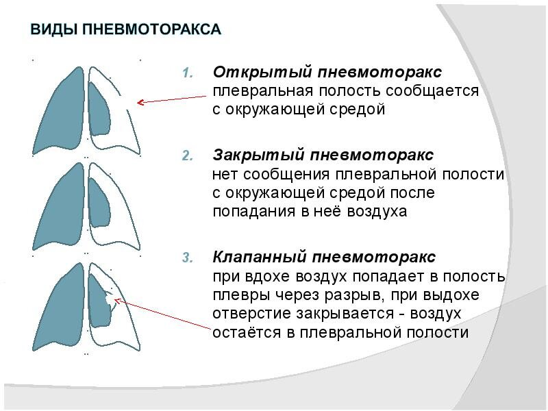 Gunshot wound to the chest - Doctors, Ambulance, Negative, Disease history, Yandex Zen, Yandex Zen (link)