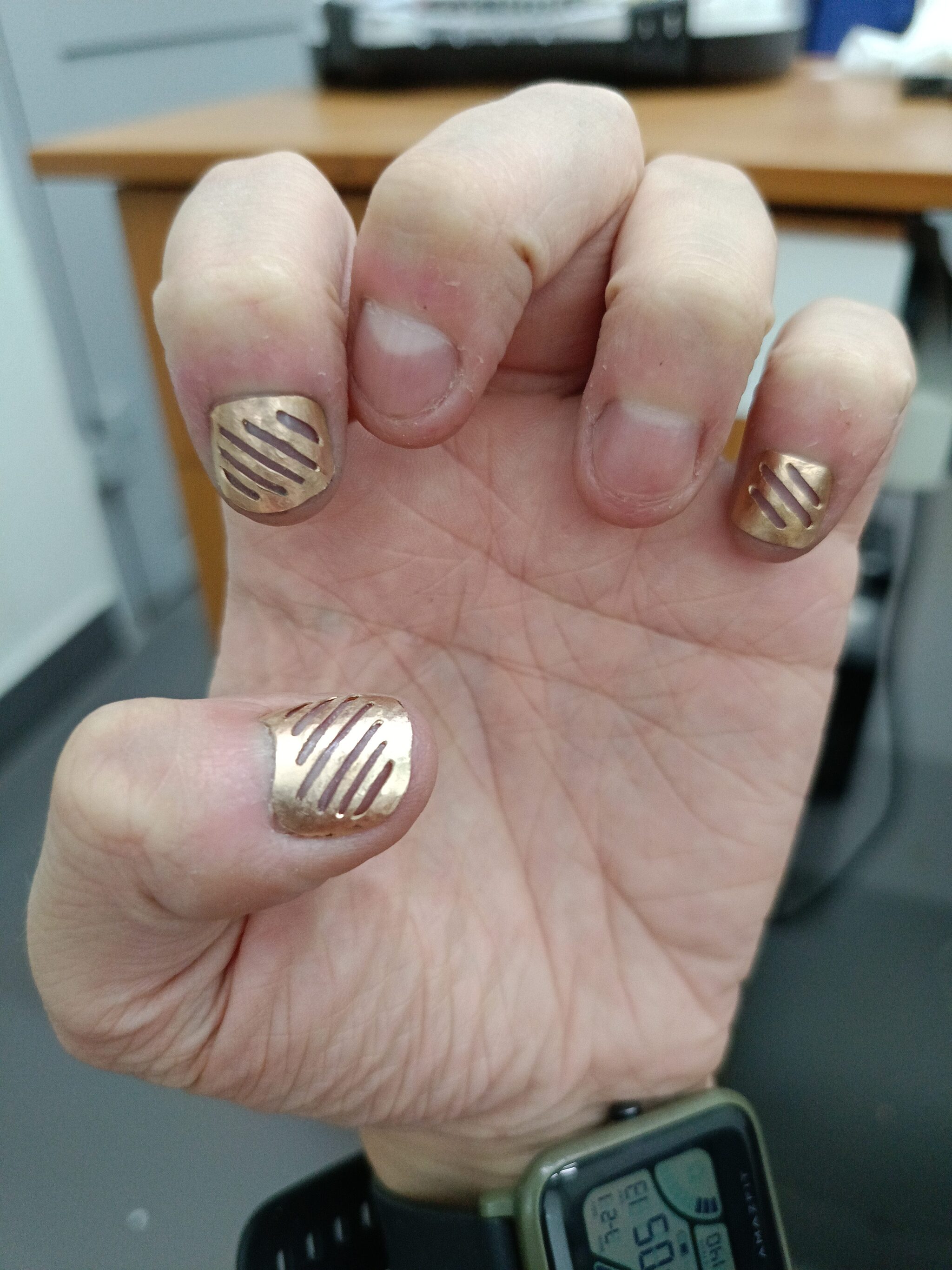 Let's bite our nails together - My, Nails, Bad habits, Longpost