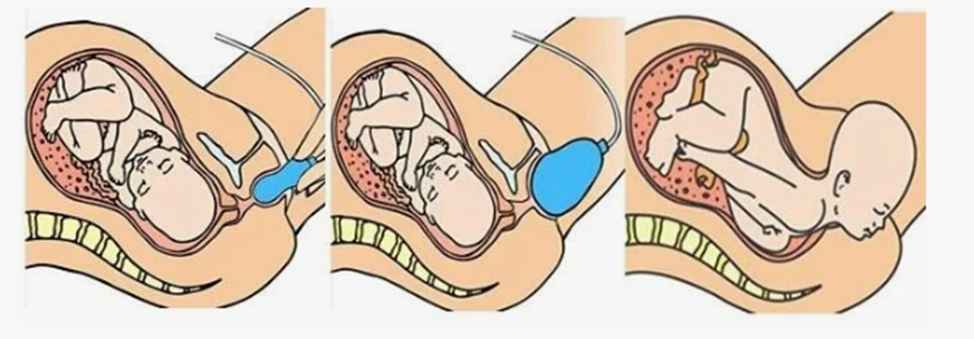 Continuation of the post Yoni massage. From anatomy to practice - Life stories, Reply to post, The medicine, Sexual health, Longpost, Sex