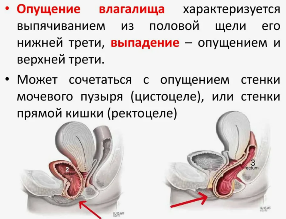 Continuation of the post Yoni massage. From anatomy to practice - Life stories, Reply to post, The medicine, Sexual health, Longpost, Sex