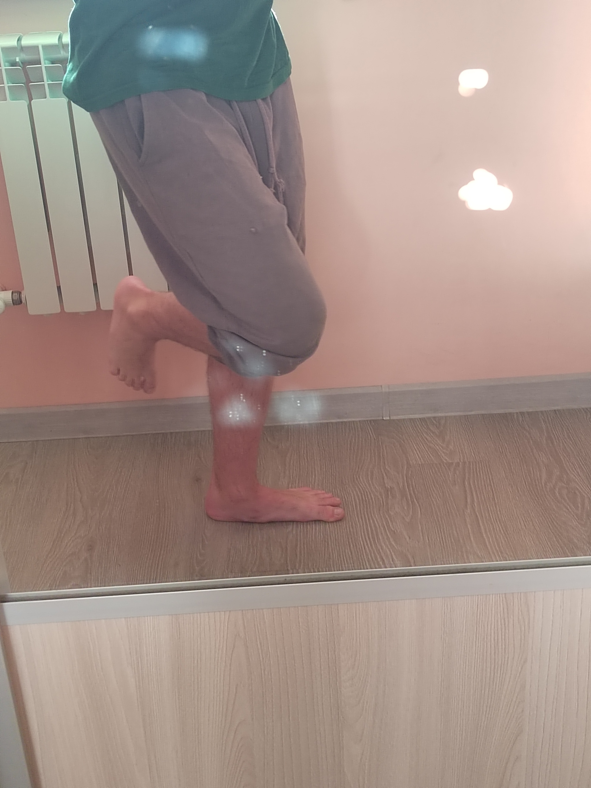 Friends, can this leg be considered a leg with grade 3 flatfoot, in your opinion? - Question, Flat feet, Longpost