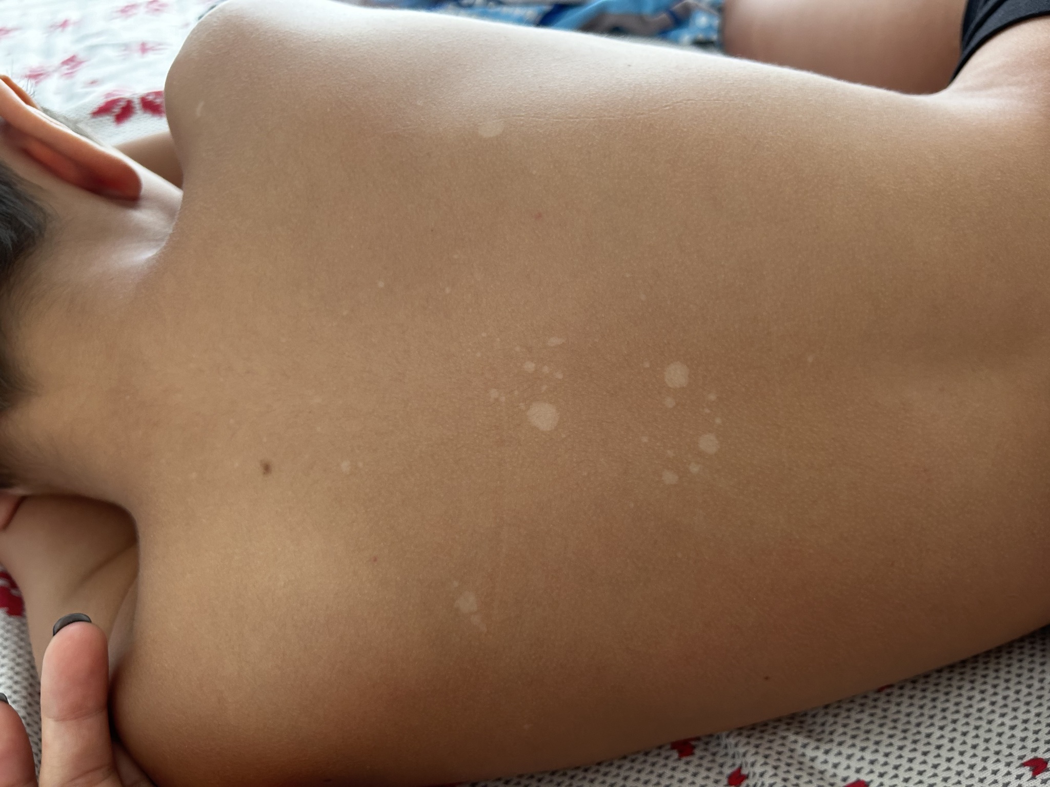 Are there any Pikabu dermatologists? - My, No rating, Dermatology, Question, Help, Children