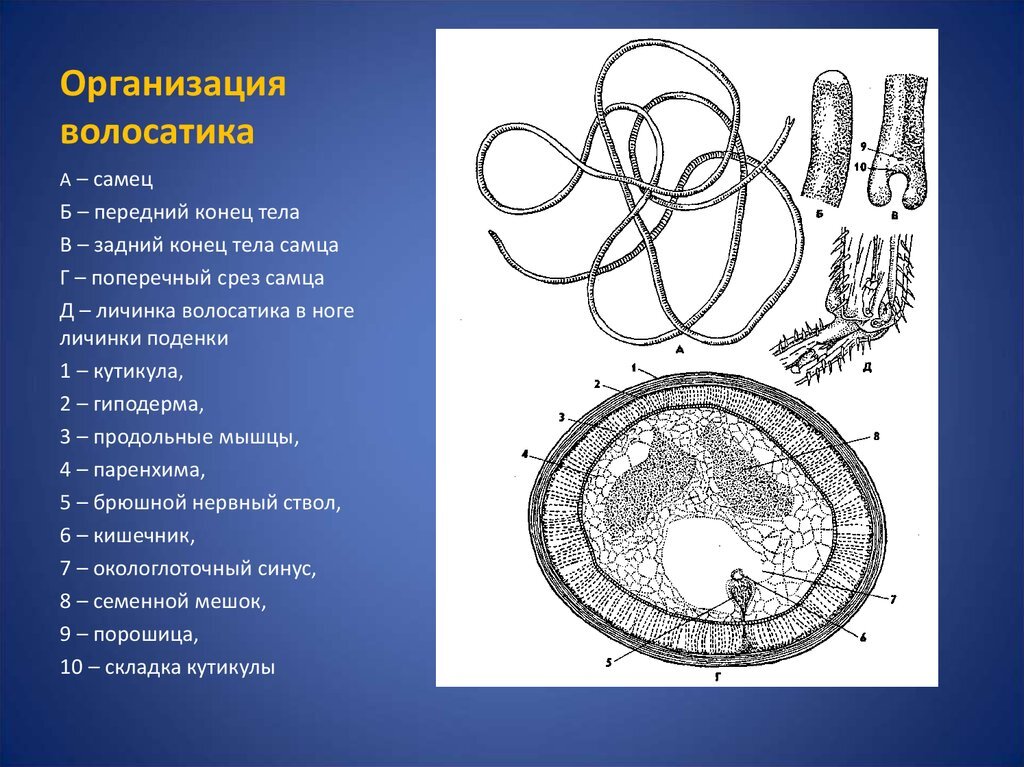 Червь-убийца беспозвоночных - Моё, Природа, Дикая природа, Червь, Паразиты, Волосатость, Конский волос, Водоем, Личинка, Яйца, Длиннопост