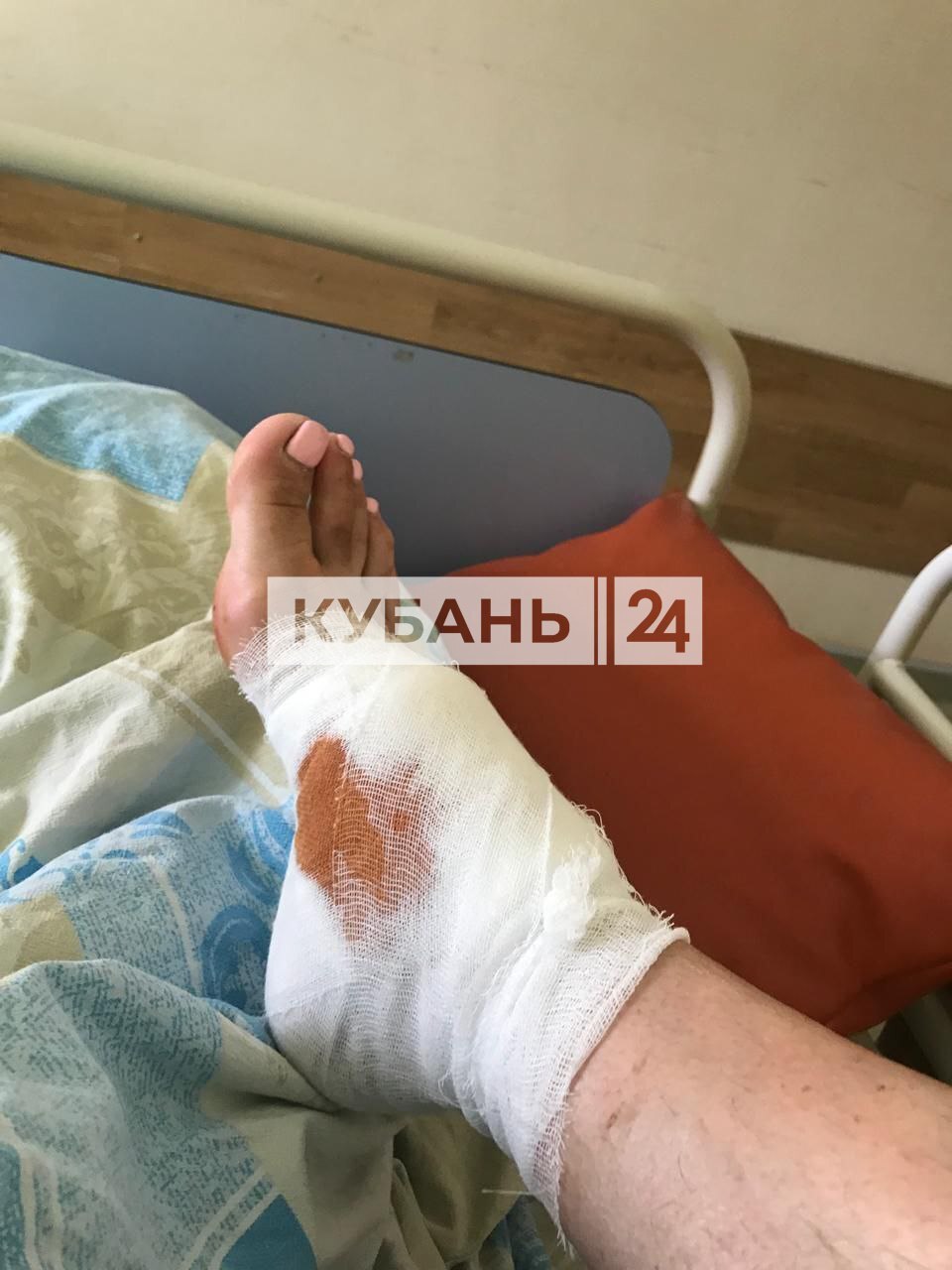 Continuation of the post In Sochi, stray dogs attacked a woman: - Radical animal protection, Dog attack, Stray dogs, Osvv, Vertical video, Telegram (link), Negative, Video, Longpost