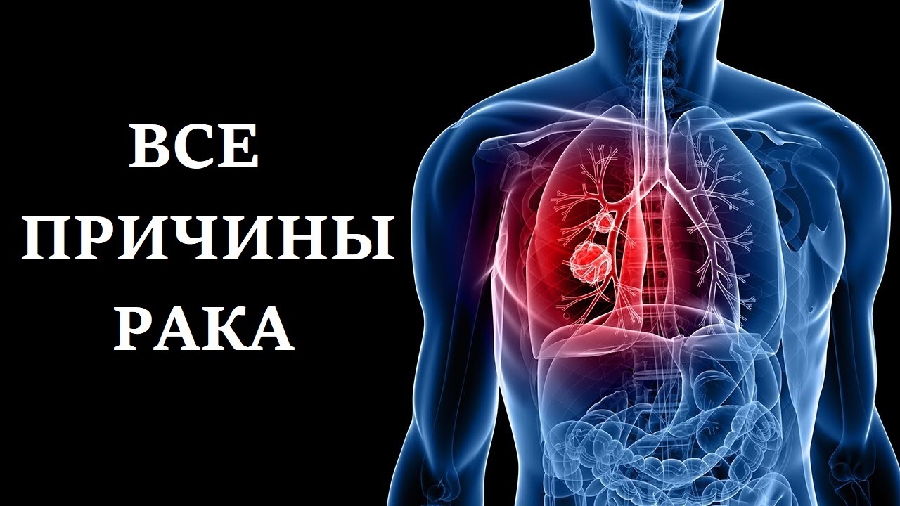 Все причины рака. Канцерогены - Моё, Здоровье, Здоровое питание, Медицина, Рак и онкология, Наука, Научпоп, Химия, Врачи, Биология, Долголетие, Веганы, Вегетарианство, ЗОЖ, Канцерогены, Дети, Повтор, Еда, Длиннопост