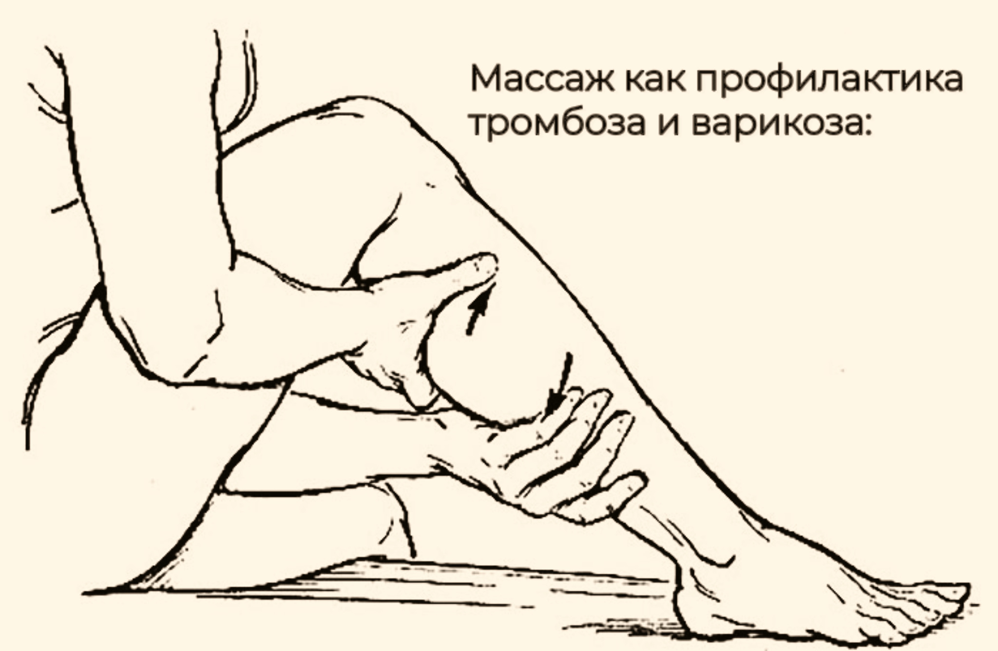 Massage as a prevention of thrombosis and varicose veins: - My, Massage, Health, Masseur, Varicose veins, Thrombosis