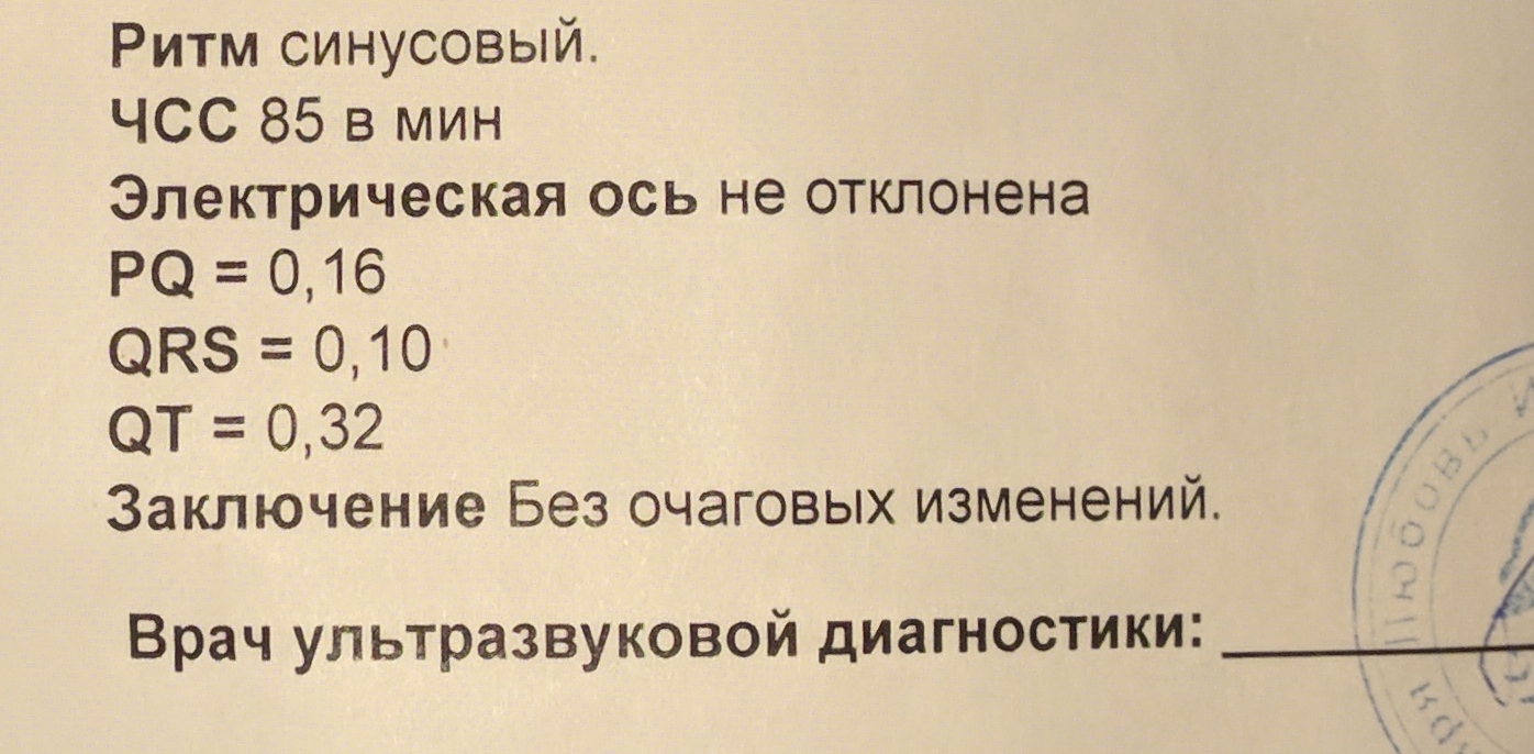 Нужная консультация терапевта или кардиолога - Моё, ЭКГ, Медицинские анализы, Сердце, Консультация, Терапевт, Кардиология