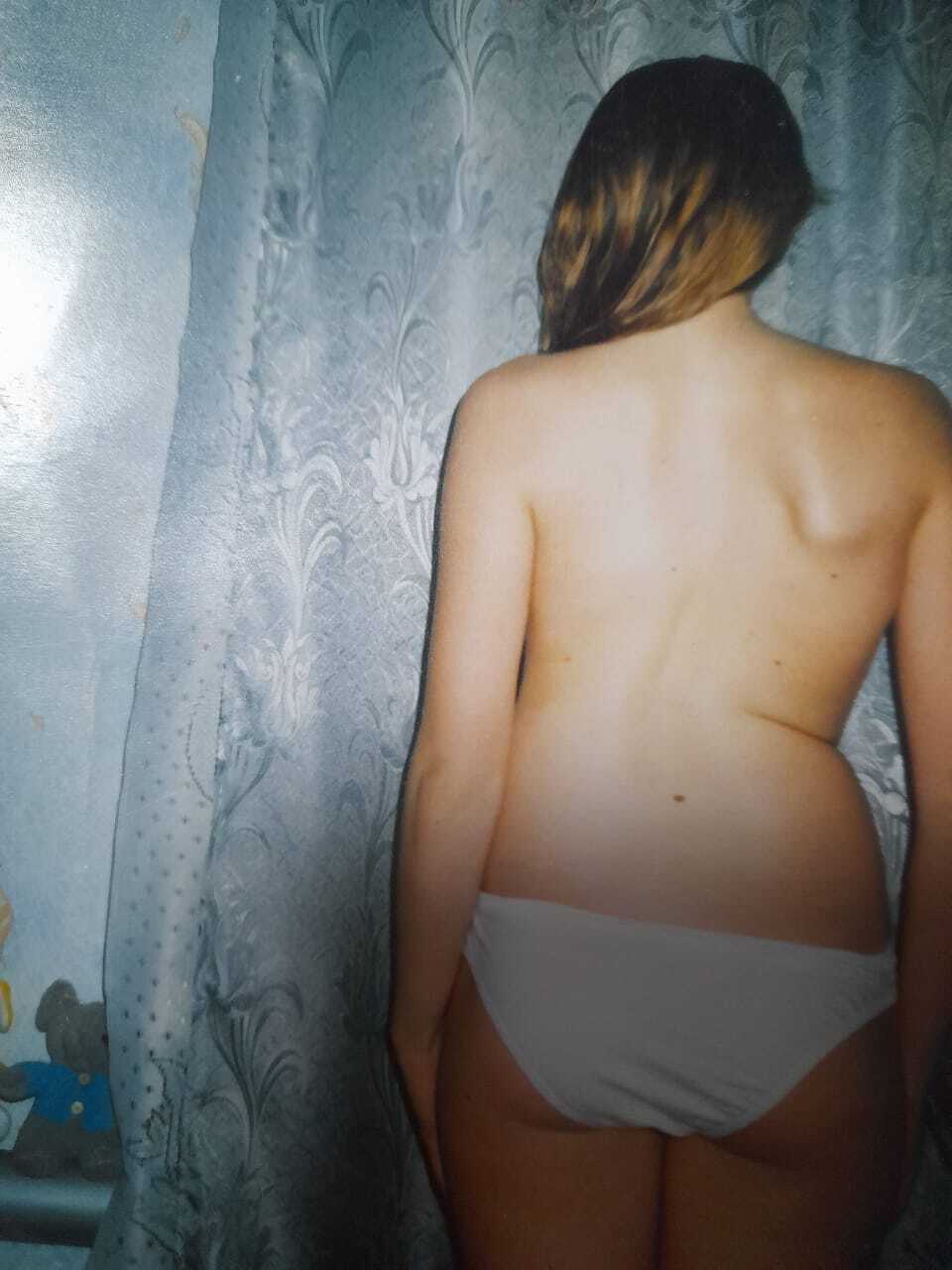 I'm No Longer the Iron Lady, or How to Treat Scoliosis Without Registration - My, Scoliosis, Operation, Recovery, Mat, Longpost