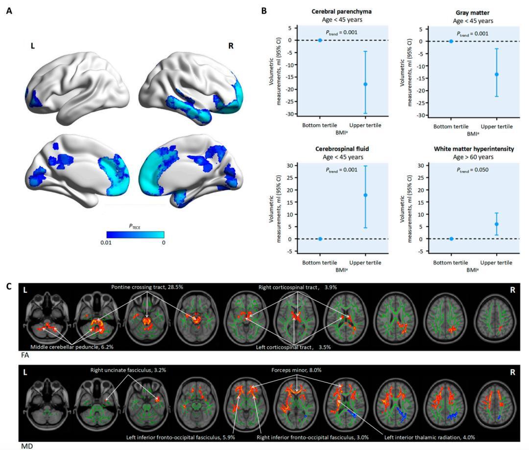 The higher the relative body weight (body mass index) - the smaller the brain - Research, Brain, Body Mass Index, The science